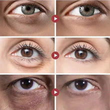 Carregar imagem no visualizador da galeria, Rolon 5 em 1 Ultra Rejuvenescedor Luteína Inova®