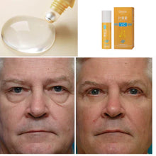 Carregar imagem no visualizador da galeria, Rolon 5 em 1 Ultra Rejuvenescedor Luteína Inova®
